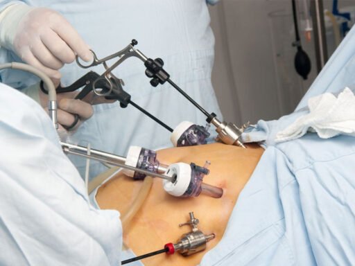 Weighing the Pros and Cons: Is Gastric Sleeve Surgery Worth It for You