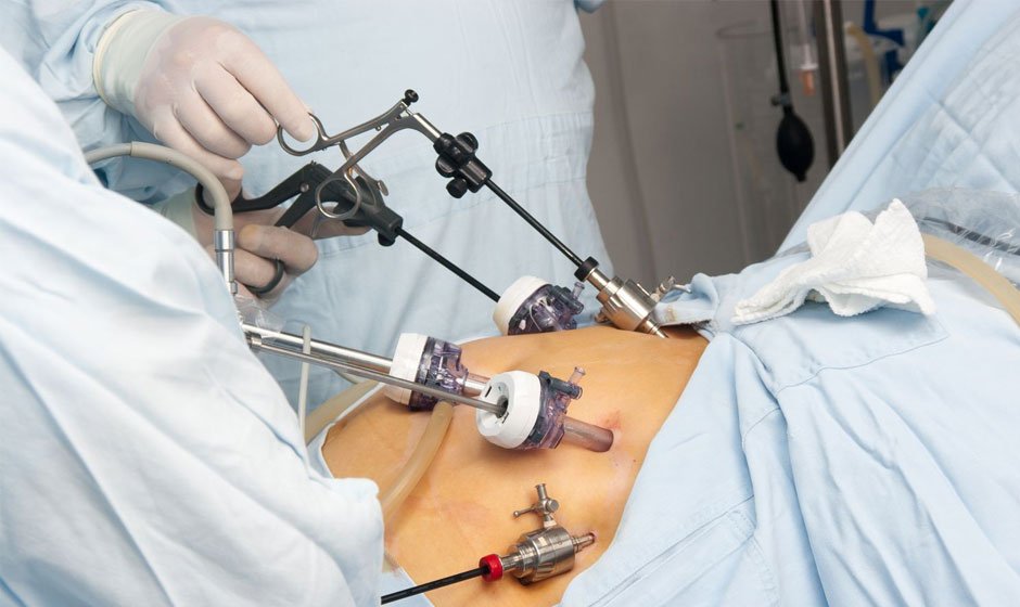 Weighing the Pros and Cons: Is Gastric Sleeve Surgery Worth It for You